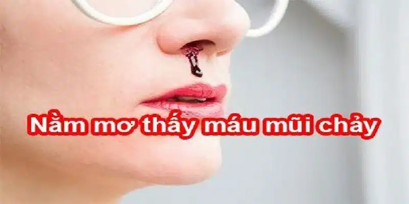 Mộng thấy chảy máu mũi là điềm báo gì?